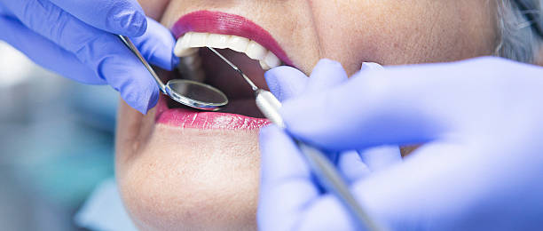 Best Knocked-Out Tooth Emergency  in Alturas, CA